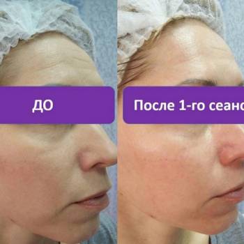 Таира Триггер, Житомир Фото - 8