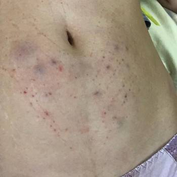 Таира Триггер, Житомир Фото - 11