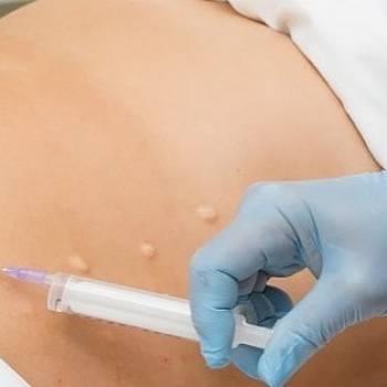 Таира Триггер, Житомир Фото - 16