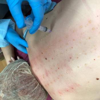 Таира Триггер, Житомир Фото - 18