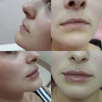 Анастасия Ефимчук Анастасія Єфимчук, Житомир Фото - 19