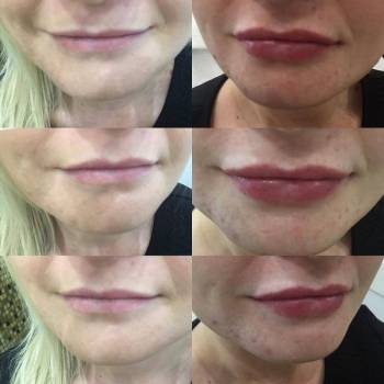 ЗДРАВО, Житомир Фото - 15