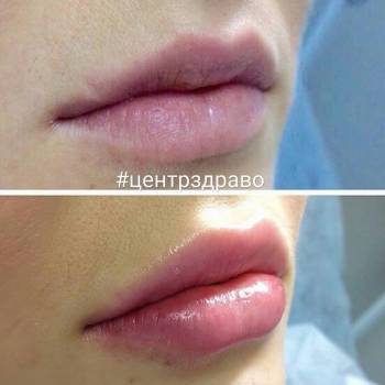 ЗДРАВО, Житомир Фото - 20