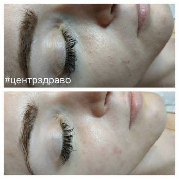 ЗДРАВО, Житомир Фото - 22