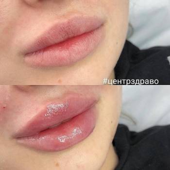 ЗДРАВО, Житомир Фото - 24