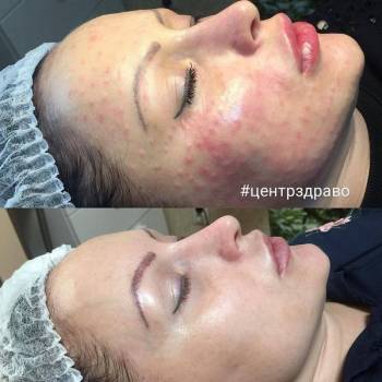 ЗДРАВО, Житомир Фото - 25