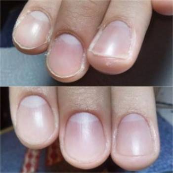 Юлия Коваленко , Днепр Фото - 7