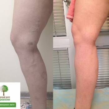 Відновлення, Житомир Фото - 23