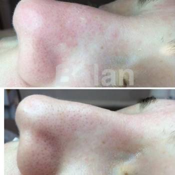 Фото с портфолио Дарья Балан 