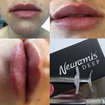 Евгения Манжина, Маріуполь Фото - 5