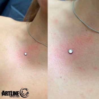 Мікродермали
                    Тату салон ArtLine Запоріжжя