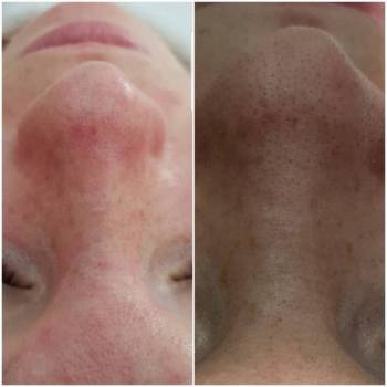 Фото с портфолио Елена 