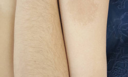 Шугаринг Лікар-косметолог Любовь Запоріжжя