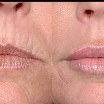 Юлия Аношенко, Сумы Фото - 7