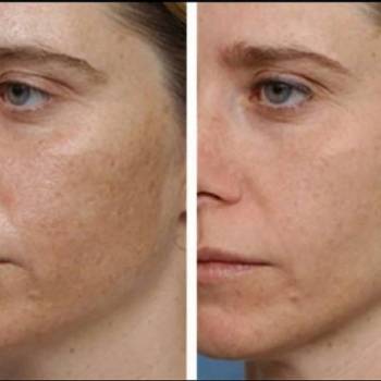 Юлия Аношенко, Сумы Фото - 8