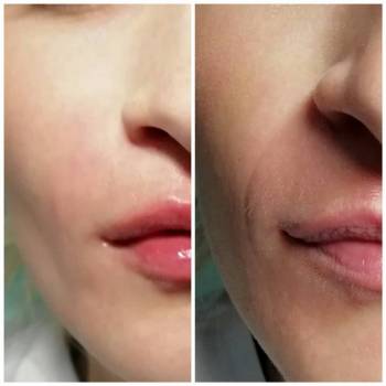 Юлия Аношенко, Сумы Фото - 10