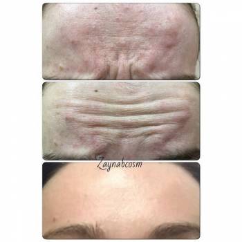 Фото с портфолио Галаева Зайнаб 