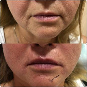 Фото с портфолио Галаева Зайнаб 