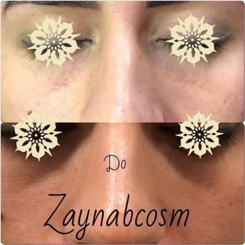 Фото с портфолио Галаева Зайнаб 