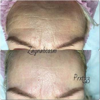 Фото с портфолио Галаева Зайнаб 