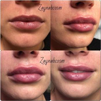 Фото с портфолио Галаева Зайнаб 