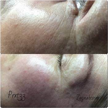 Фото с портфолио Галаева Зайнаб 