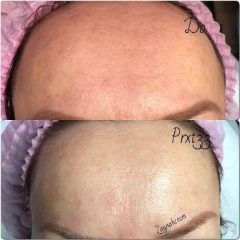 Фото с портфолио Галаева Зайнаб 