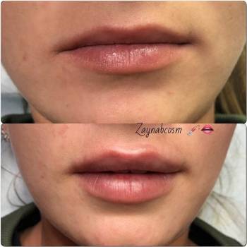 Фото с портфолио Галаева Зайнаб 