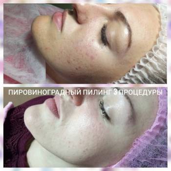 Фото с портфолио Марина Дычко 