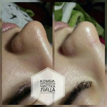 Фото с портфолио Марина Дычко 