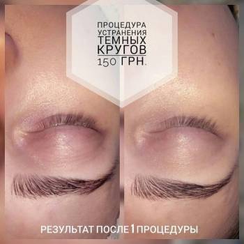 Фото с портфолио Марина Дычко 