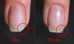 Ремонт ногтей Мастер маникюра Олеся Музыка Одесса