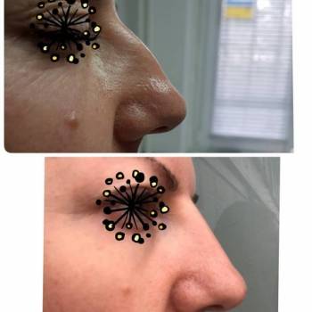 Наталья Еременко, Суми Фото - 33