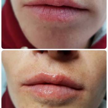 Наталья Еременко, Суми Фото - 34