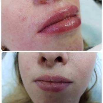 Наталья Еременко, Суми Фото - 35