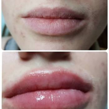 Наталья Еременко, Суми Фото - 36