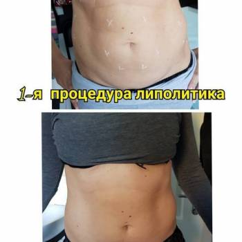 Наталья Еременко, Суми Фото - 37