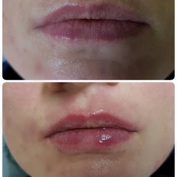 Наталья Еременко, Суми Фото - 41