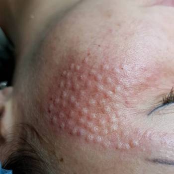 Наталья Еременко, Суми Фото - 42