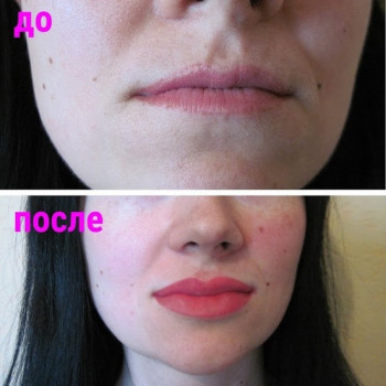 Перманентний макіяж/татуаж губ
                    Майстер перманентного макіяжу Марина Київ