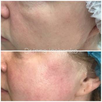 Helena Beauty Club, Сумы Фото - 6