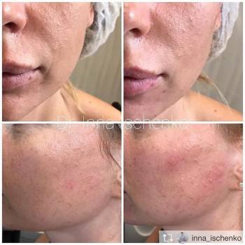 Helena Beauty Club, Сумы Фото - 28