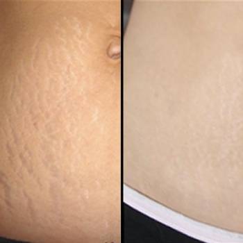 Фото с портфолио FataMin