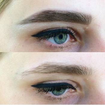 Альбина , Вінниця Фото - 14