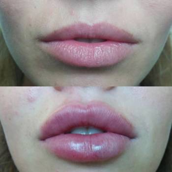 Фото с портфолио BES Studio Estetico