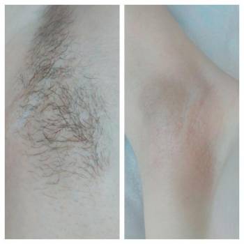 Зоя Райз , Мариуполь Фото - 6