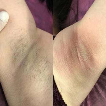 Даша Зарецкая , Сумы Фото - 13