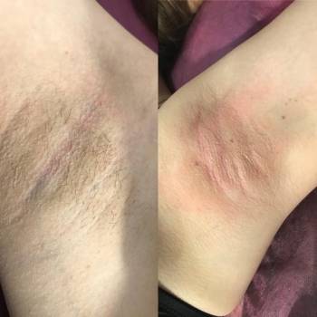 Даша Зарецкая , Сумы Фото - 14