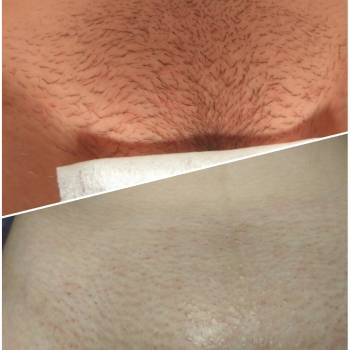 Глубокое бикини