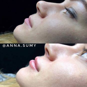 Анна , Суми Фото - 24